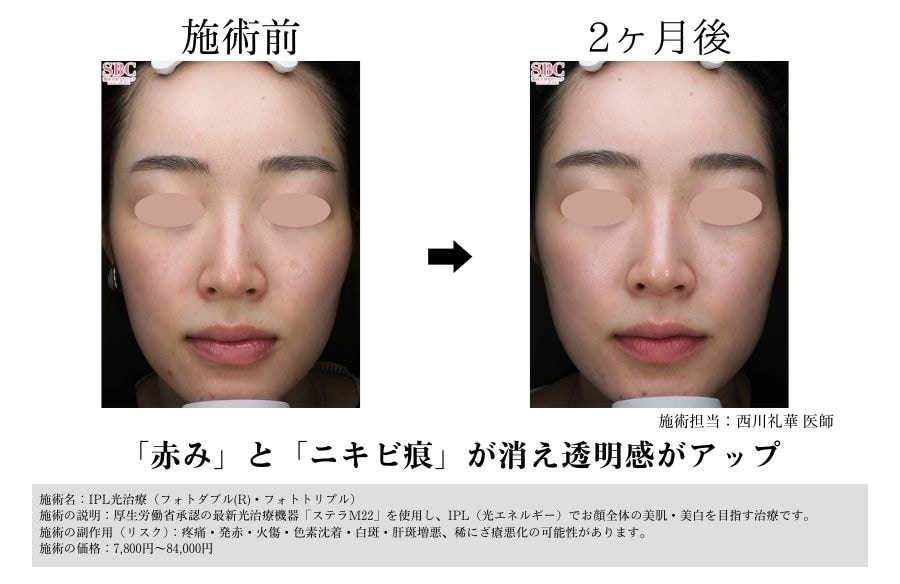 フォトダブル®︎